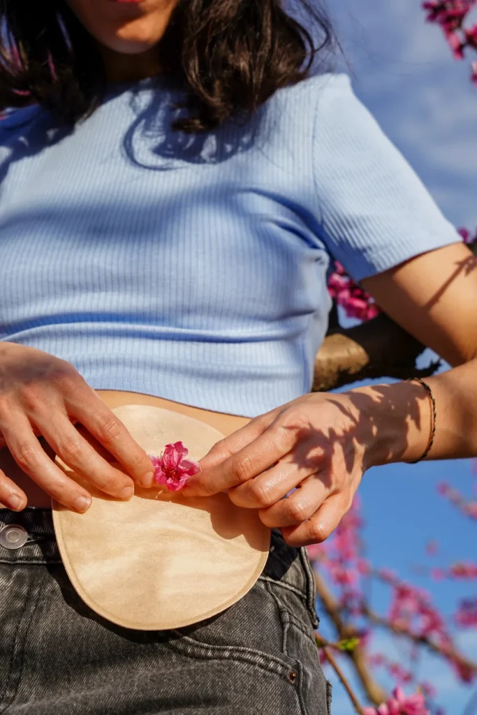 Ragazza irriconoscibile che decora la sua borsa per stomia con un fiore rosa